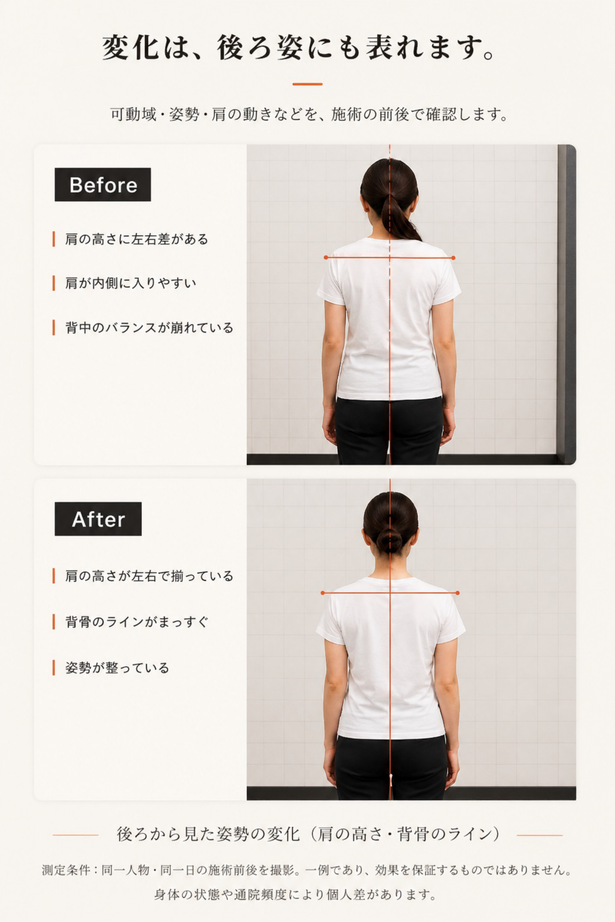 Before/After：後ろから見た姿勢の変化